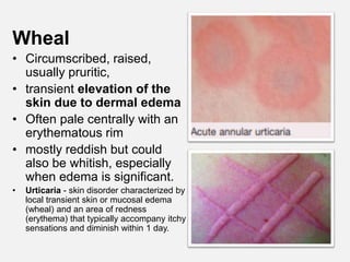 Wheals Examples fundamentals of dermatology HO final.pptx