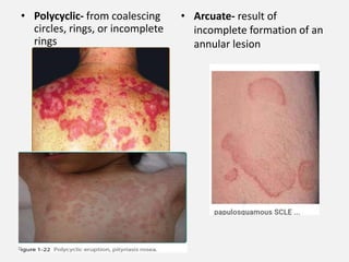 fundamentals of dermatology HO final.pptx