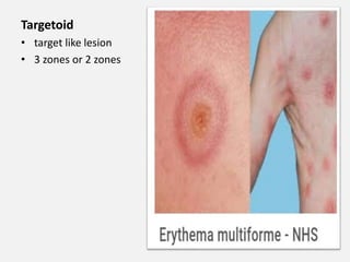 fundamentals of dermatology HO final.pptx