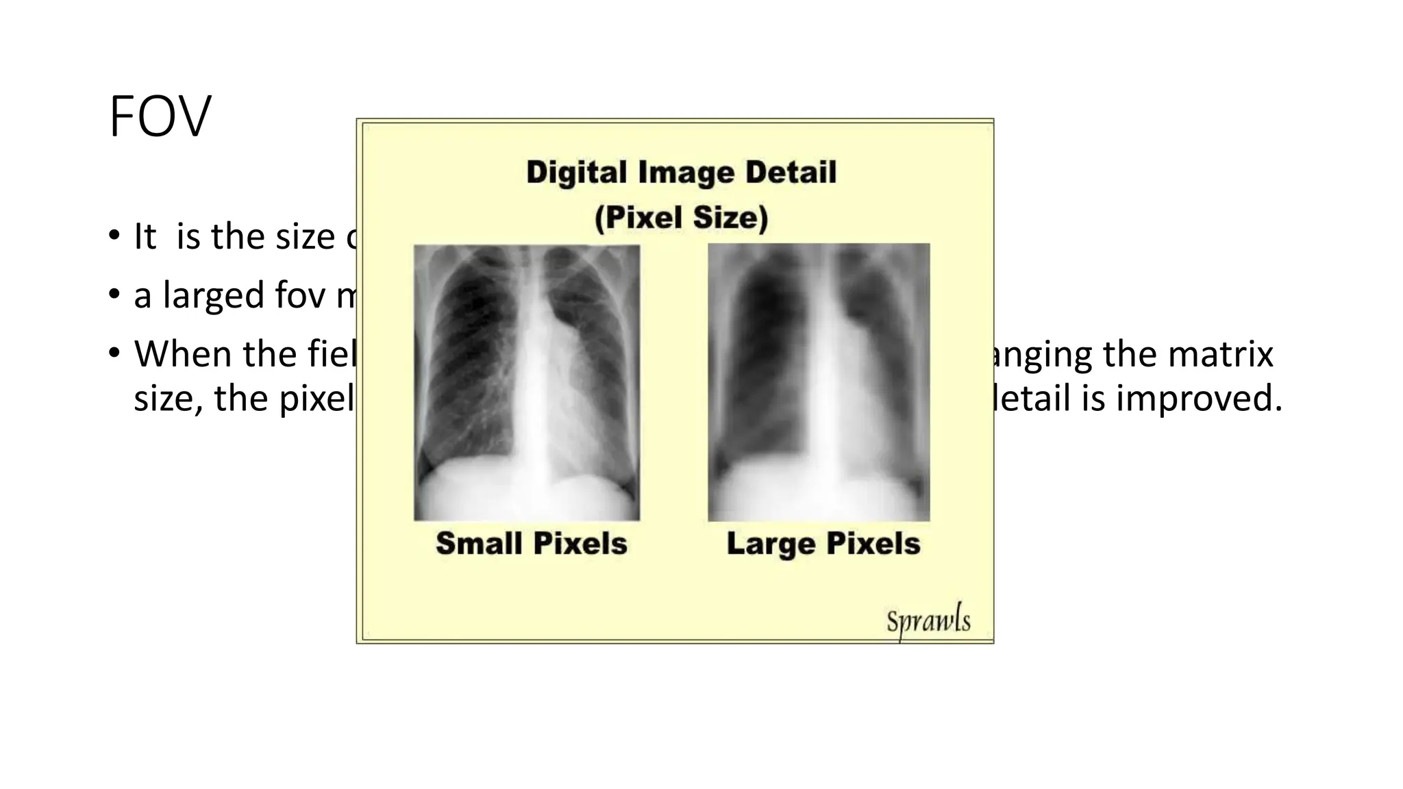 FOV
• It is the size of the area to be imaged.
• a larged fov means a larger area to be imaged.
• When the field of view (FOV) is reduced, but not changing the matrix
size, the pixels become smaller and the visibility of detail is improved.
 