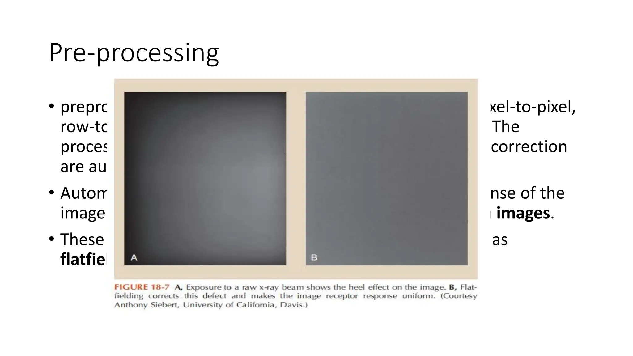 Pre-processing
• preprocessing provides electronic calibration to reduce pixel-to-pixel,
row-to-row, and column-to-column response differences. The
processes of pixel interpolation, lag correction, and noise correction
are automatically applied with most systems.
• Automatic calibration images designed to make the response of the
image receptor uniform are called Offset images and gain images.
• These preprocessing calibration techniques are identified as
flatfielding.
 