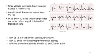 Vt R Wave Fundamentals of Electrocardiography | PPTX