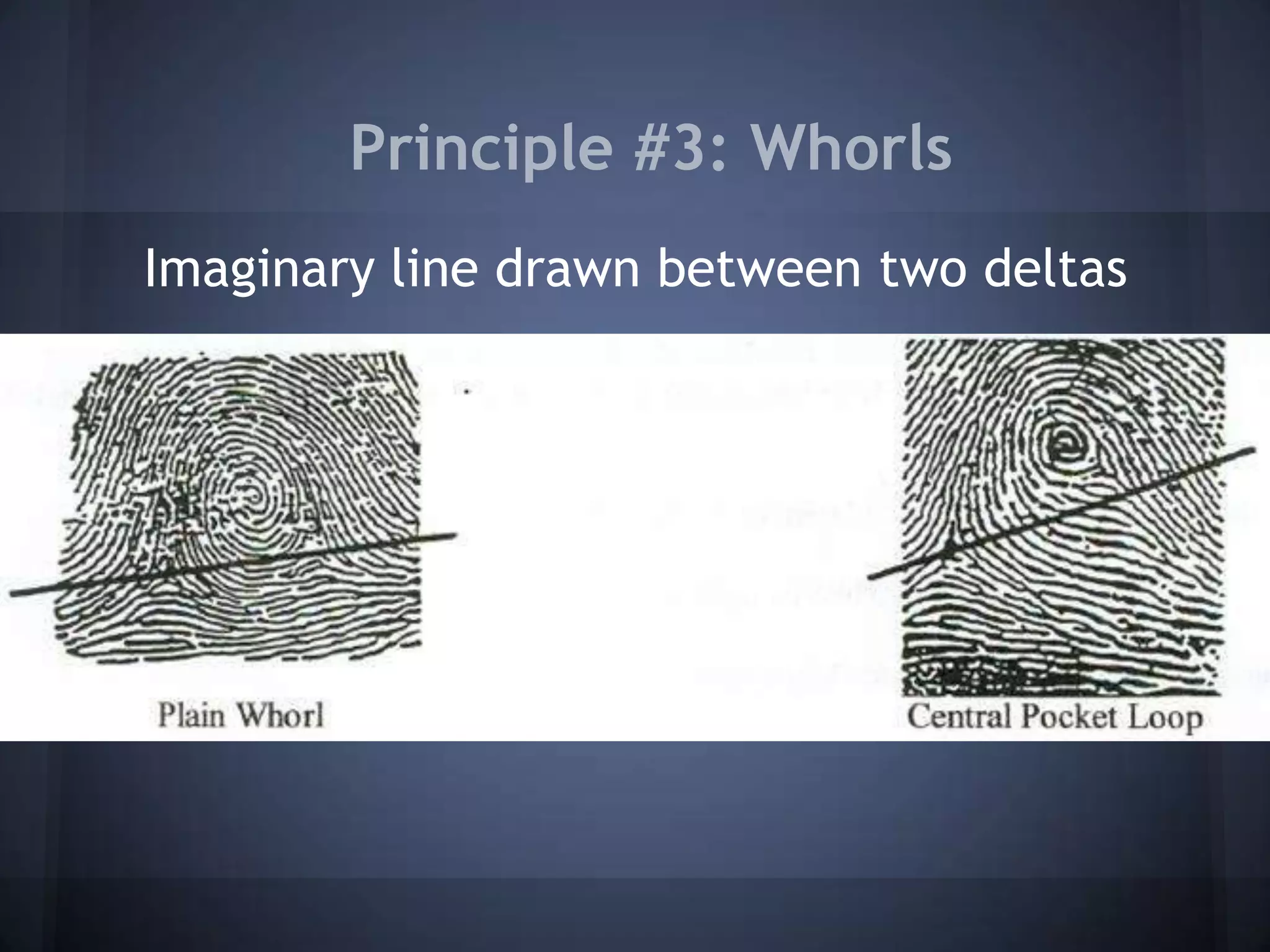 Principle #3: Whorls
Imaginary line drawn between two deltas
 