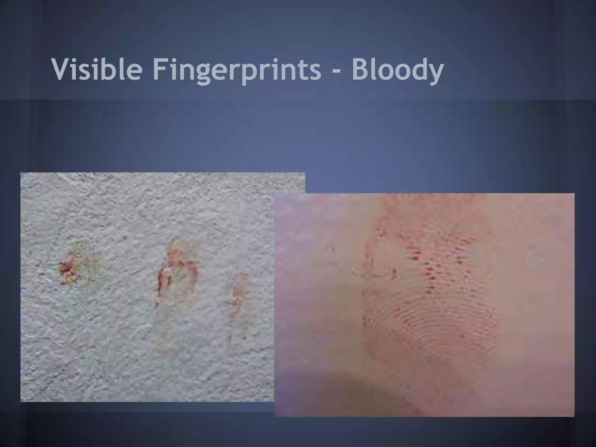 Visible Fingerprints - Bloody
 