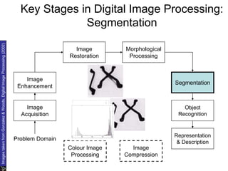 Key Stages in Digital Image Processing:
Segmentation
Image
Acquisition
Image
Restoration
Morphological
Processing
Segmentation
Representation
& Description
Image
Enhancement
Object
Recognition
Problem Domain
Colour Image
Processing
Image
Compression
Images
taken
from
Gonzalez
&
Woods,
Digital
Image
Processing
(2002)
 