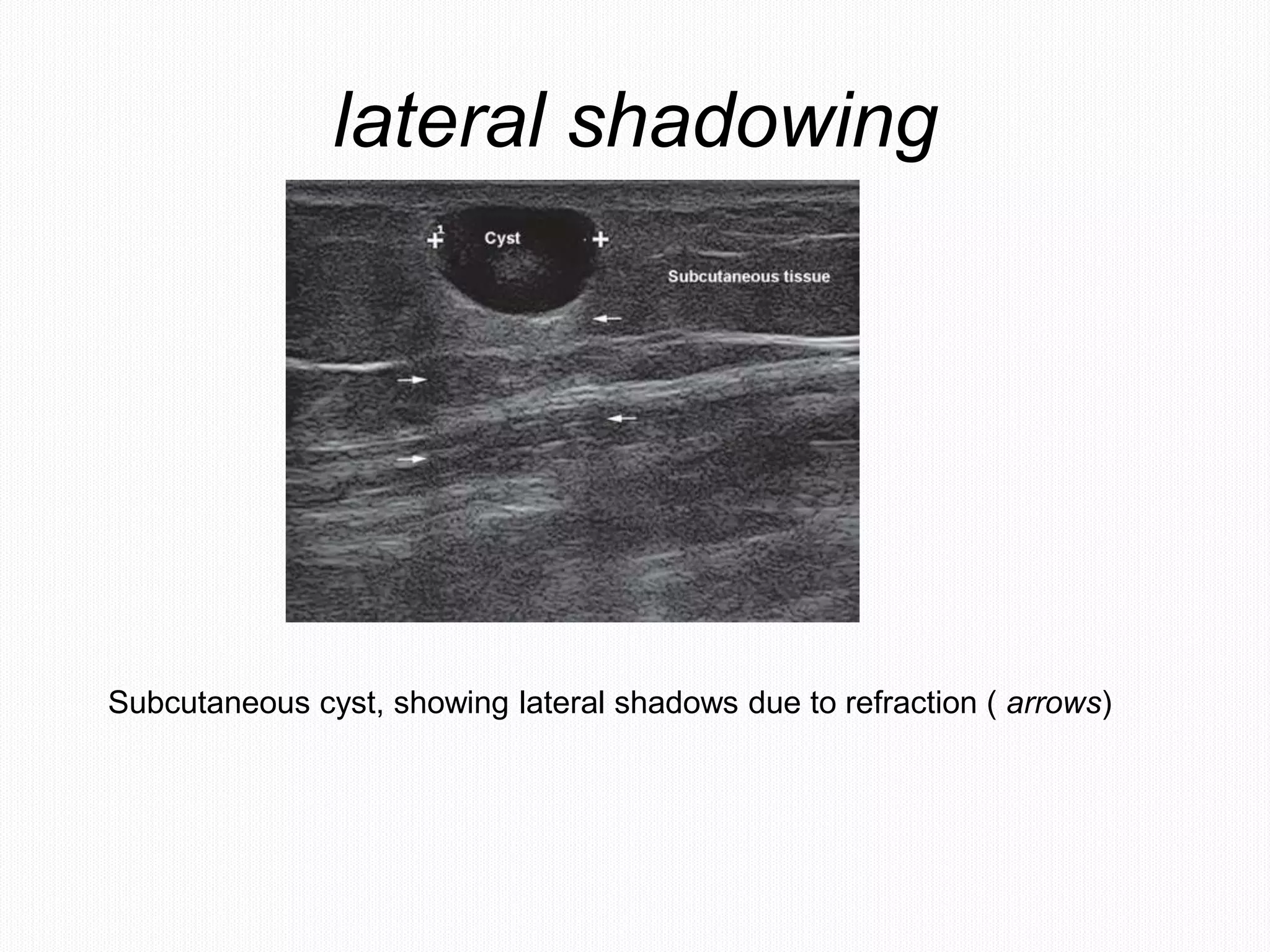 Fundamentals of musculoskeletal ultrasound | PPTX
