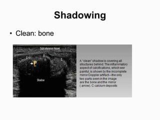 Fundamentals of musculoskeletal ultrasound | PPTX