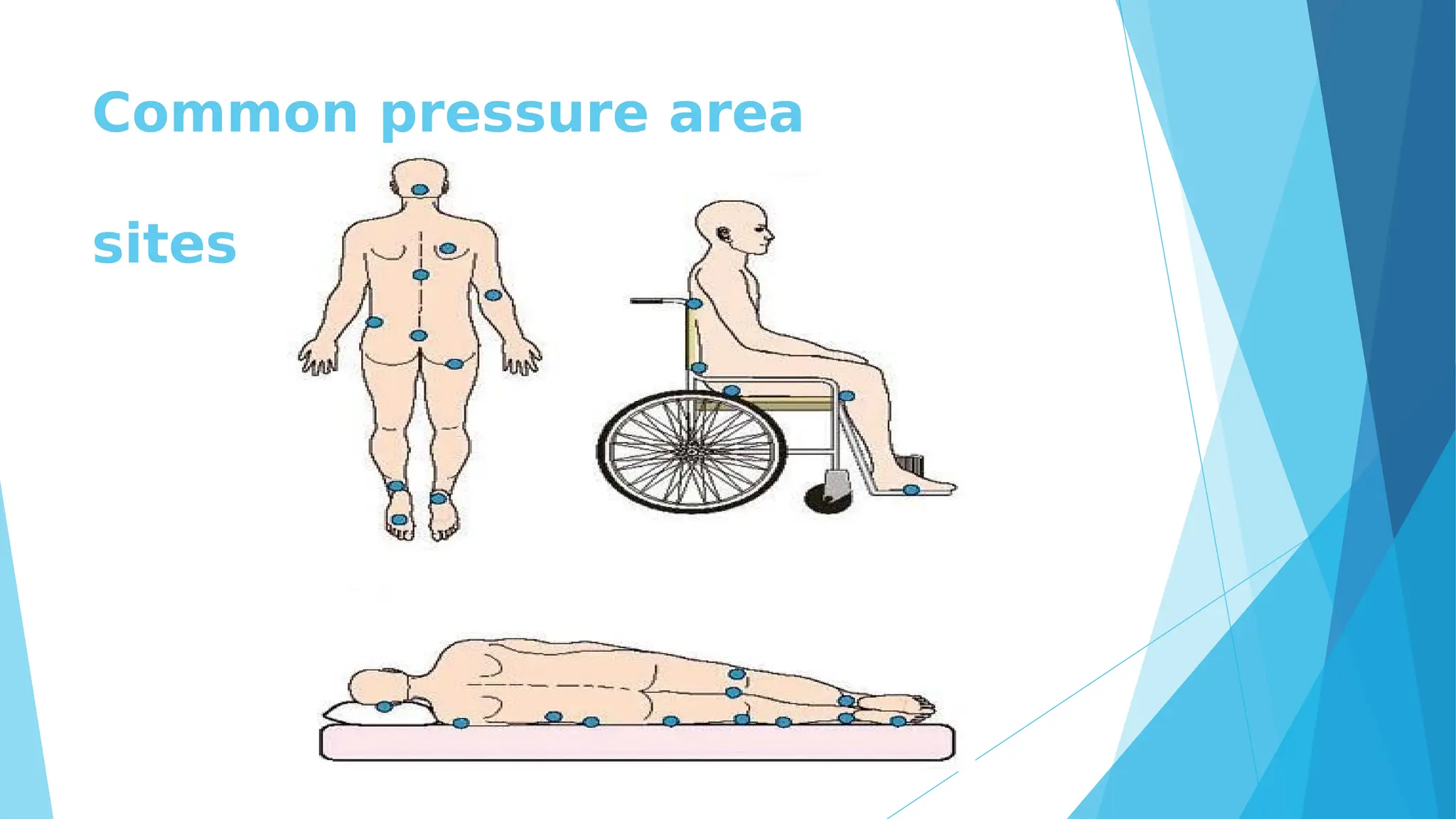 FUNDAMENTALS+OF+NURSING+PRACTICE+1+LECTURE+PRESSURE+AREA+CARE.pdf
