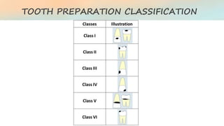 Tooth Case Classification Fundamentals of Cavity preparation | PPTX