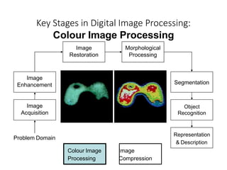 Key Stages in Digital Image Processing:
Colour Image Processing
Image
Acquisition
Image
Restoration
Morphological
Processing
Segmentation
Image
Enhancement
Object
Recognition
Representation
& Description
Problem Domain
Colour Image
Processing
Image
Compression
 