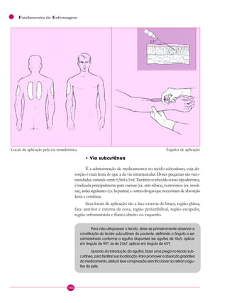 102
Fundamentos de Enfermagem
• Via subcutânea
É a administração de medicamentos no tecido subcutâneo, cuja ab-
sorção é mais lenta do que a da via intramuscular. Doses pequenas são reco-
mendadas,variandoentre0,5mla1ml.Tambémconhecidacomohipodérmica,
é indicada principalmente para vacinas (ex.anti-rábica),hormônios (ex.insuli-
na),anticoagulantes(ex.heparina)eoutrasdrogasquenecessitamdeabsorção
lenta e contínua.
Seus locais de aplicação são a face externa do braço, região glútea,
face anterior e externa da coxa, região periumbilical, região escapular,
região inframamária e flanco direito ou esquerdo.
Para não ultrapassar o tecido, deve-se primeiramente observar a
constituição do tecido subcutâneo do paciente, definindo o ângulo a ser
administrado conforme a agulha disponível (se agulha de 10x5, aplicar
em ângulo de 90º; se de 25x7, aplicar em ângulo de 45º).
Quando da introdução da agulha, fazer uma prega no tecido sub-
cutâneo, para facilitar sua localização. Para promover a absorção gradativa
do medicamento, efetuar leve compressão sem friccionar ao retirar a agu-
lha da pele.
15º
Locais de aplicação pela via intradérmica Ângulos de aplicação
 