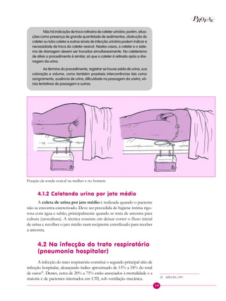 59
P E
A
ROF
Não há indicação de troca rotineira de cateter urinário; porém, situa-
ções como presença de grande quantidade de sedimentos, obstrução do
cateter ou tubo coletor e outros sinais de infecção urinária podem indicar a
necessidade de troca do cateter vesical. Nestes casos, o cateter e o siste-
ma de drenagem devem ser trocados simultaneamente. No cateterismo
de alívio o procedimento é similar, só que o cateter é retirado após a dre-
nagem da urina.
Ao término do procedimento, registrar se houve saída de urina, sua
coloração e volume, como também possíveis intercorrências tais como
sangramento, ausência de urina, dificuldade na passagem da uretra, vá-
rias tentativas de passagem e outras.
Fixação da sonda vesical na mulher e no homem
4.1.2 Coletando urina por jato médio
A coleta de urina por jato médio é realizada quando o paciente
não se encontra cateterizado. Deve ser precedida de higiene íntima rigo-
rosa com água e sabão, principalmente quando se trata de amostra para
cultura (urocultura). A técnica consiste em deixar correr o fluxo inicial
de urina e recolher o jato médio num recipiente esterilizado para receber
a amostra.
4.2 Na infecção do trato respiratório
(pneumonia hospitalar)
A infecção do trato respiratório constitui o segundo principal sítio de
infecção hospitalar, alcançando índice aproximado de 13% a 18% do total
de casos22
. Destes, cerca de 20% a 75% estão associados à mortalidade e a
maioria é de pacientes internados em UTI, sob ventilação mecânica. 22 APECIH, 1997.
 