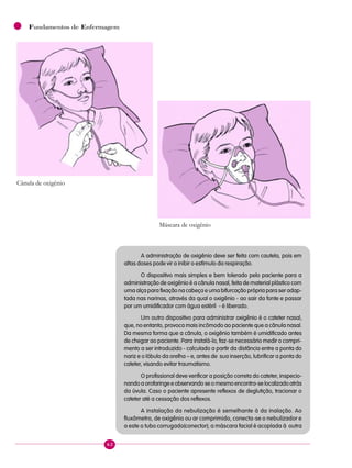 62
Fundamentos de Enfermagem
A administração de oxigênio deve ser feita com cautela, pois em
altas doses pode vir a inibir o estímulo da respiração.
O dispositivo mais simples e bem tolerado pelo paciente para a
administração de oxigênio é a cânula nasal, feita de material plástico com
uma alça para fixação na cabeça e uma bifurcação própria para ser adap-
tada nas narinas, através da qual o oxigênio - ao sair da fonte e passar
por um umidificador com água estéril - é liberado.
Um outro dispositivo para administrar oxigênio é o cateter nasal,
que, no entanto, provoca mais incômodo ao paciente que a cânula nasal.
Da mesma forma que a cânula, o oxigênio também é umidificado antes
de chegar ao paciente. Para instalá-lo, faz-se necessário medir o compri-
mento a ser introduzido - calculado a partir da distância entre a ponta do
nariz e o lóbulo da orelha – e, antes de sua inserção, lubrificar a ponta do
cateter, visando evitar traumatismo.
O profissional deve verificar a posição correta do cateter, inspecio-
nando a orofaringe e observando se o mesmo encontra-se localizado atrás
da úvula. Caso o paciente apresente reflexos de deglutição, tracionar o
cateter até a cessação dos reflexos.
A instalação da nebulização é semelhante à da inalação. Ao
fluxômetro, de oxigênio ou ar comprimido, conecta-se o nebulizador e
a este o tubo corrugado(conector); a máscara facial é acoplada à outra
Máscara de oxigênio
Cânula de oxigênio
 