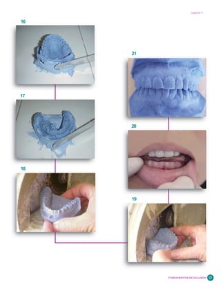 Capítulo 4


16




     21




17




     20




18




     19




          FUNDAMENTOS DE OCLUSIÓN   53
 