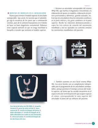 Capítulo 4

                                                                1. Veremos un articulador semiajustable del sistema
                                                             Whip-Mix, que facilita el diagnóstico instrumental y la
   MONTAJE DE MODELOS EN EL ARTICULADOR                      elaboración de ajustes en modelos, elaboración de pró-
   Técnica para orientar el modelo superior al articulador   tesis provisionales y definitivas, guardas oclusales, etc.
semiajustable tipo arcón. Se necesita que el odontólo-       Este tipo de articuladores lleva los elementos condilares
go siga la secuencia de los pasos que a continuación         en la parte inferior y las guías condilares en la parte
veremos, pues de lo contrario fracasaremos en el intento     superior. Recibe las relaciones dentoaxiocraneales y
de hacer un buen diagnóstico instrumental. Debemos           copia los tres centros de rotación del movimiento
tener especial atención en que no tenga movilidad la         mandibular y una vez ajustados sus controles simulará
horquilla o tenedor que sostienen al modelo superior.        los movimientos mandibulares del paciente.




                                                                 2. También usaremos un arco facial sistema Whip-
                                                             Mix. Los arcos faciales son un complemento indispen-
                                                             sable para la programación de los articuladores semiajus-
                                                             tables, porque permiten el montaje correcto del mode-
                                                             lo superior, de forma que las arcadas encuentren en el
                                                             espacio articular la misma posición que ocupan respecto
                                                             al cráneo, correspondiendo la rama superior del
                                                             articulador al plano del eje orbitario del paciente.


    Arco facial del whip-mix DB 2000: A , horquilla
    intraoral; B , perno de unión vertical; C , barra
    transversal; D , tornillo de bloqueo del perno; E,E,
                         F,
    doble abrazadera; F, tornillo de bloqueo de la
    doble abrazadera (no visible en esta ilustración);
                            H,
    G, olivas auriculares; H, tornillo de bloqueo de
    los dos brazos del arco.

                                                                                              FUNDAMENTOS DE OCLUSIÓN     57
 