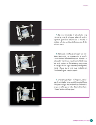 Capítulo 4




   7. Se pone invertido el articulador y se
coloca la cera de céntrica sobre el modelo
superior, poniendo encima de la misma el
modelo inferior, verificando la conexión de las
indentaciones.




    8. Se mezcla yeso hasta conseguir una con-
sistencia cremosa y se coloca sobre la superfi-
cie de montaje del modelo inferior. Se cierra el
articulador ejerciendo presión con el dedo para
que no se produzcan alteraciones y se vigila que
el vástago incisal haga contacto con la platina
incisal y luego que el yeso haga contacto con
ésta hasta fraguar completamente.




   9. Una vez que el yeso ha fraguado, se vol-
tea el articulador a su posición original hasta
ver que el vástago descanse en la platina incisal,
lo que es señal que no hubo distorsión o altera-
ción de la dimensión vertical.




                             FUNDAMENTOS DE OCLUSIÓN    59
 
