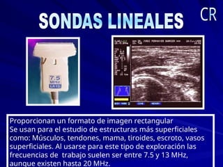 Proporcionan un formato de imagen rectangular
Se usan para el estudio de estructuras más superficiales
como: Músculos, tendones, mama, tiroides, escroto, vasos
superficiales. Al usarse para este tipo de exploración las
frecuencias de trabajo suelen ser entre 7.5 y 13 MHz,
aunque existen hasta 20 MHz.
 