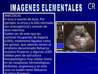 ANECOICAS
Si ecos o exento de ecos. Por
ejemplo, la orina y la bilis normales
son anecogénicas ( carecen de
ecos internos).
Suelen ser de este tipo las
Lesiones Ocupantes de Espacio
(LOES), totalmente líquidas como
los quistes, que además tienen el
Artefacto denominado Refuerzo
Acústico Posterior y algunas LOES
sólidas pero de estructura
histopatológica muy celular como
en las neoplasias hematológicas,
(linfomas, angiomas) y en este
caso no suelen tener Refuerzo
 