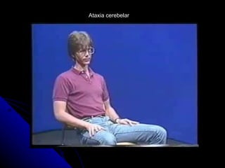 Ataxia cerebelar 