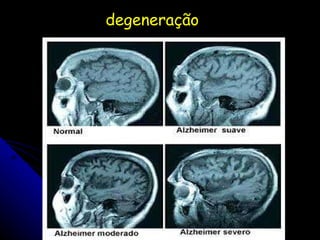 degeneração 