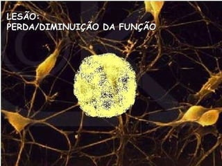 LESÃO:  PERDA/DIMINUIÇÃO DA FUNÇÃO 