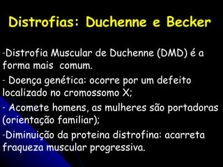 Distrofias: Duchenne e Becker   Distrofia Muscular de Duchenne (DMD) é a forma mais  comum.  Doença genética: ocorre por um defeito localizado no cromossomo X; Acomete homens, as mulheres são portadoras (orientação familiar); Diminuição da proteina  distrofina: acarreta fraqueza muscular progressiva .  