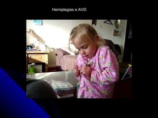 Hemiplegias e AVD 