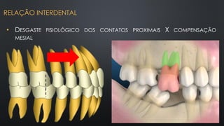• DESGASTE FISIOLÓGICO DOS CONTATOS PROXIMAIS X COMPENSAÇÃO
MESIAL
RELAÇÃO INTERDENTAL
 
