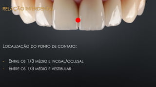 LOCALIZAÇÃO DO PONTO DE CONTATO:
- ENTRE OS 1/3 MÉDIO E INCISAL/OCLUSAL
- ENTRE OS 1/3 MÉDIO E VESTIBULAR
RELAÇÃO INTERDENTAL
 