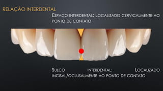 SULCO INTERDENTAL: LOCALIZADO
INCISAL/OCLUSALMENTE AO PONTO DE CONTATO
ESPAÇO INTERDENTAL: LOCALIZADO CERVICALMENTE AO
PONTO DE CONTATO
RELAÇÃO INTERDENTAL
 