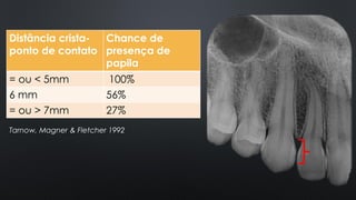 Distância crista-
ponto de contato
Chance de
presença de
papila
= ou < 5mm 100%
6 mm 56%
= ou > 7mm 27%
Tarnow, Magner & Fletcher 1992
 