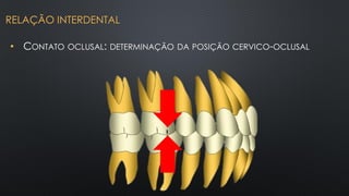 • CONTATO OCLUSAL: DETERMINAÇÃO DA POSIÇÃO CERVICO-OCLUSAL
RELAÇÃO INTERDENTAL
 