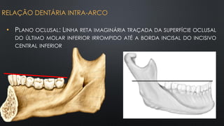 • PLANO OCLUSAL: LINHA RETA IMAGINÁRIA TRAÇADA DA SUPERFÍCIE OCLUSAL
DO ÚLTIMO MOLAR INFERIOR IRROMPIDO ATÉ A BORDA INCISAL DO INCISIVO
CENTRAL INFERIOR
RELAÇÃO DENTÁRIA INTRA-ARCO
 