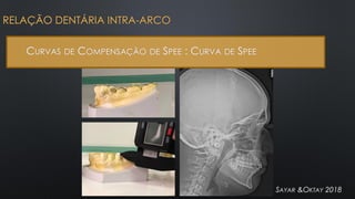 RELAÇÃO DENTÁRIA INTRA-ARCO
CURVAS DE COMPENSAÇÃO DE SPEE : CURVA DE SPEE
SAYAR &OKTAY 2018
 