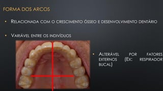 • RELACIONADA COM O CRESCIMENTO ÓSSEO E DESENVOLVIMENTO DENTÁRIO
FORMA DOS ARCOS
• VARIÁVEL ENTRE OS INDIVÍDUOS
• ALTERÁVEL POR FATORES
EXTERNOS (EX: RESPIRADOR
BUCAL)
 