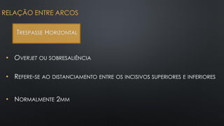 • OVERJET OU SOBRESALIÊNCIA
RELAÇÃO ENTRE ARCOS
TRESPASSE HORIZONTAL
• REFERE-SE AO DISTANCIAMENTO ENTRE OS INCISIVOS SUPERIORES E INFERIORES
• NORMALMENTE 2MM
 
