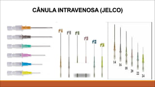 CÂNULA INTRAVENOSA (JELCO)
 