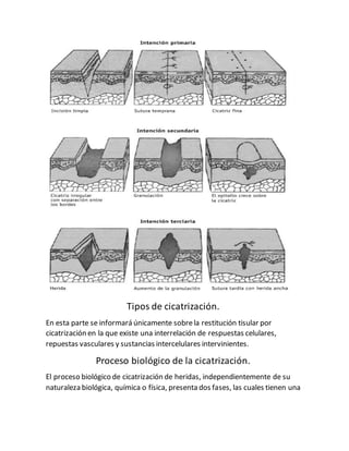 Tipos de cicatrización.
En esta parte se informará únicamente sobrela restitución tisular por
cicatrización en la que existe una interrelación de respuestas celulares,
repuestas vasculares y sustancias intercelulares intervinientes.
Proceso biológico de la cicatrización.
El proceso biológico de cicatrización de heridas, independientemente de su
naturaleza biológica, química o física, presenta dos fases, las cuales tienen una
 