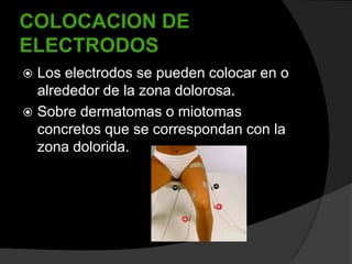 COLOCACION DE
ELECTRODOS
Los electrodos se pueden colocar en o
alrededor de la zona dolorosa.
 Sobre dermatomas o miotomas
concretos que se correspondan con la
zona dolorida.


 