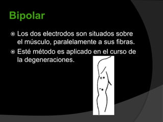 Bipolar
Los dos electrodos son situados sobre
el músculo, paralelamente a sus fibras.
 Esté método es aplicado en el curso de
la degeneraciones.


 