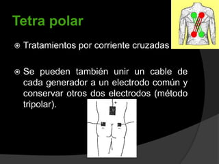 Tetra polar


Tratamientos por corriente cruzadas



Se pueden también unir un cable de
cada generador a un electrodo común y
conservar otros dos electrodos (método
tripolar).

 