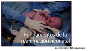 Fundamentos de la
reanimación neonatal
Lic. Enf. Sherley Saboya Jauregui
 