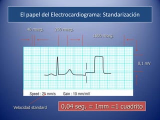 El papel del Electrocardiograma: Standarización

       40 mseg.      200 mseg.
                                  1000 mseg.




                                                 0,1 mV




Velocidad standard      0,04 seg. = 1mm =1 cuadrito
 