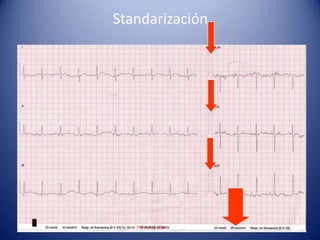 Standarización
 