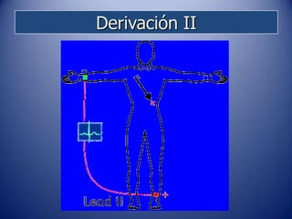 Derivación II
 