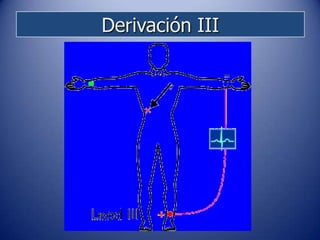 Derivación III
 