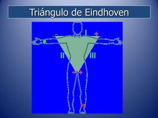 Triángulo de Eindhoven
 