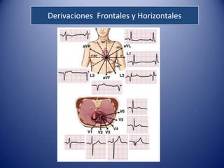 Derivaciones Frontales y Horizontales
 