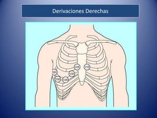 Derivaciones Derechas
 