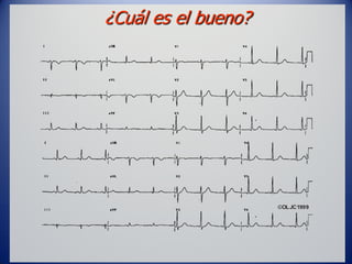 ¿Cuál es el bueno?
 